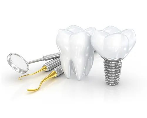 Types of Dental Implant Procedures