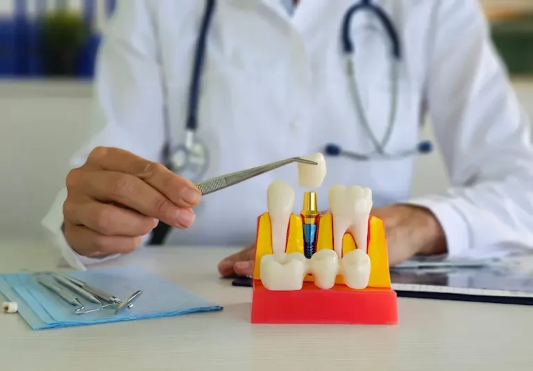 A dentist demonstrates the benefits of dental implants using model teeth.