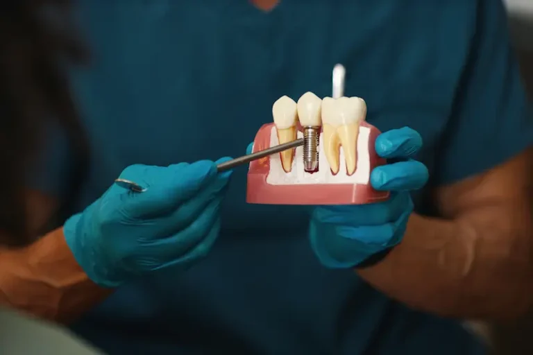 A dentist explains the dental implant process using model teeth.