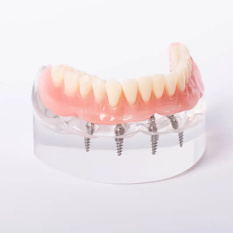 implant supported bottom dentures in fake jaw