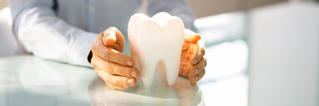 SE Dental Implant