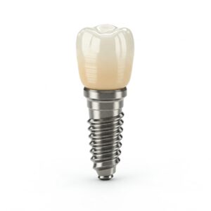 Dental Implant