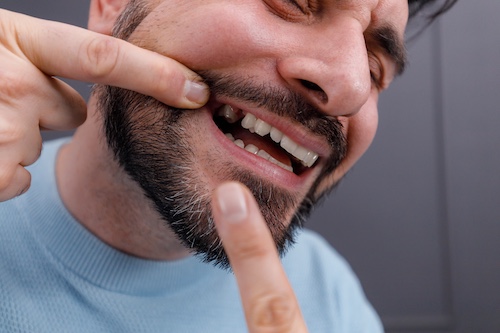 Man With Missing Tooth